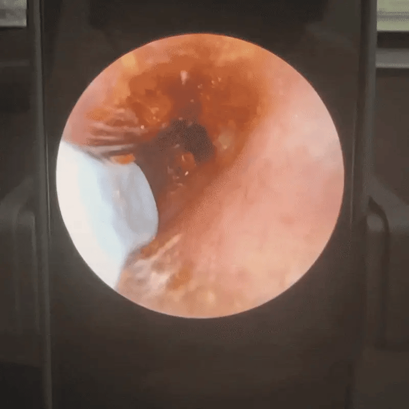 Otoskop z kamerą do czyszczenia uszu - EarWax