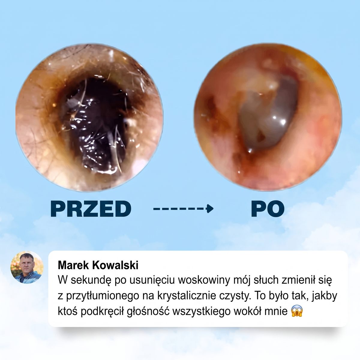 Otoskop z kamerą do czyszczenia uszu - EarWax
